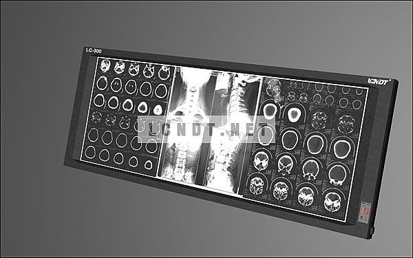 Medical 3-section LED Film Viewer  LC-300H/D