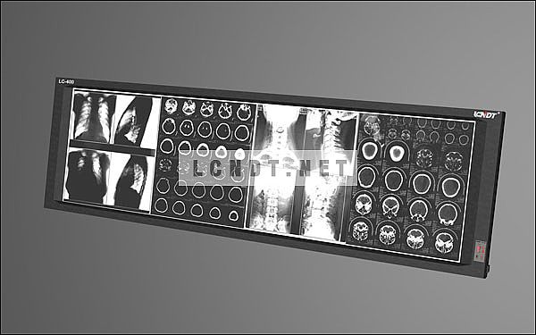 Medical 4-Section LED Film Viewer  LC-400H/D