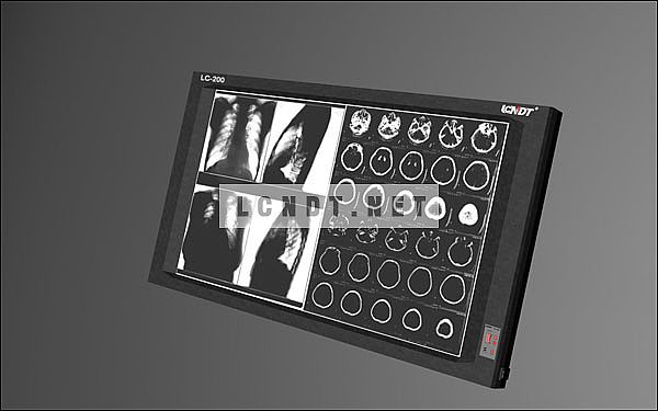 Medical Double section LED Film Viewer  LC-200H/D
